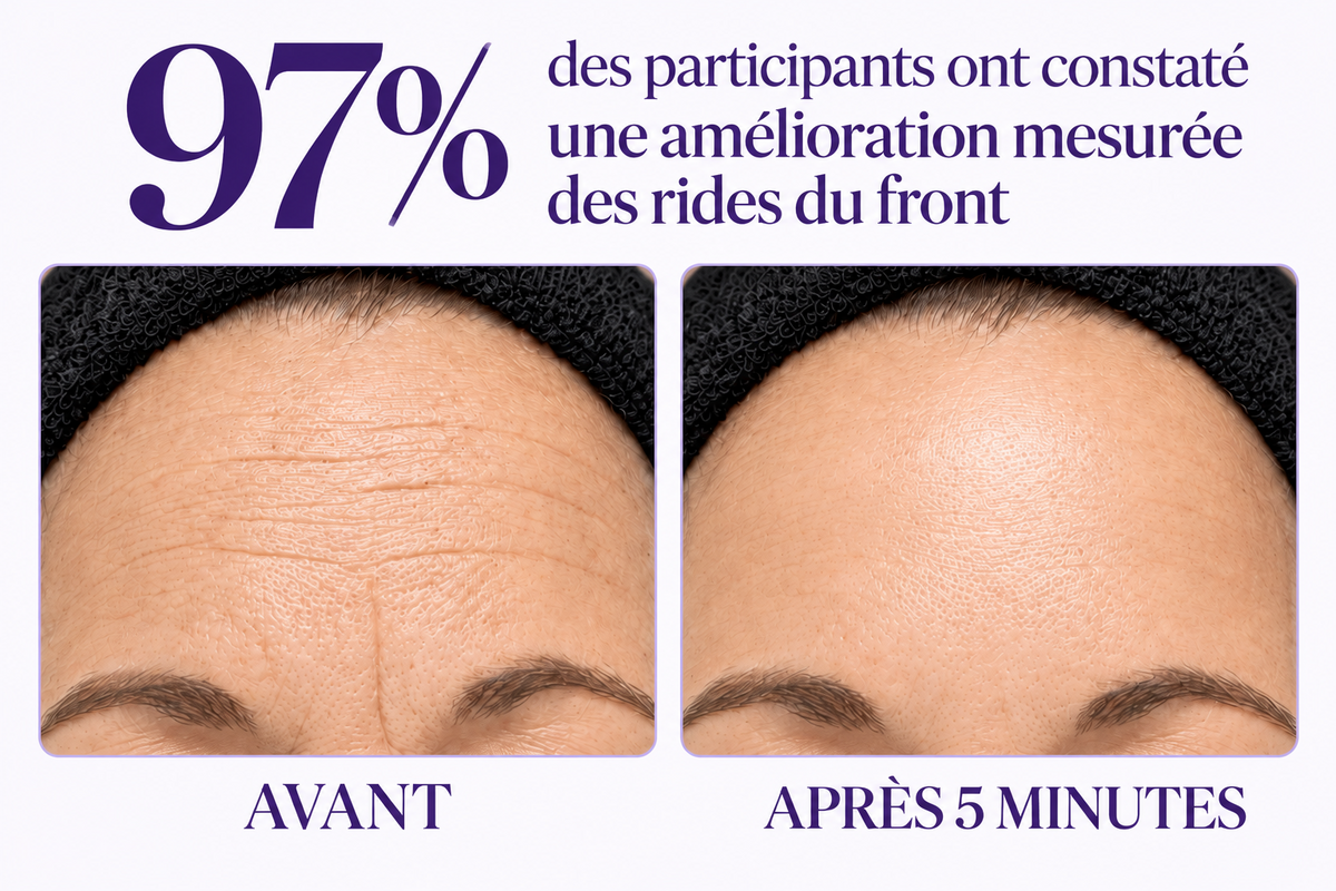 Gel Contour des Yeux — Effet Lifting Instantané