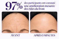Gel Contour des Yeux — Effet Lifting Instantané